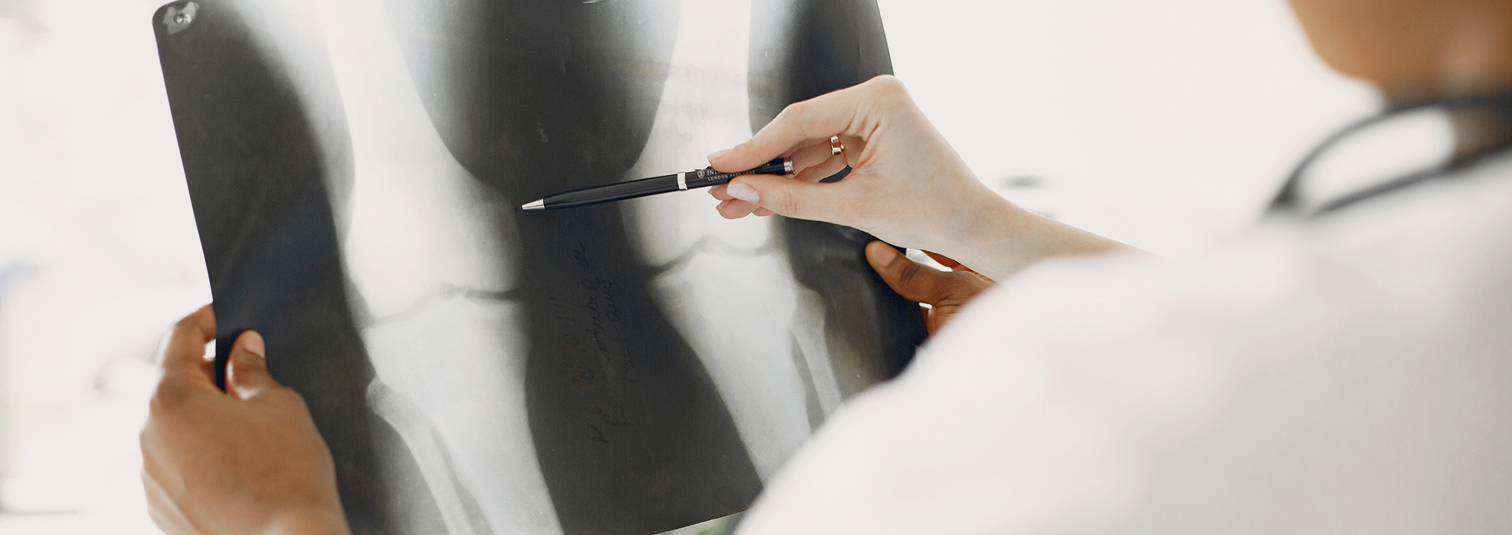 Total Hip Replacement Doctor Review